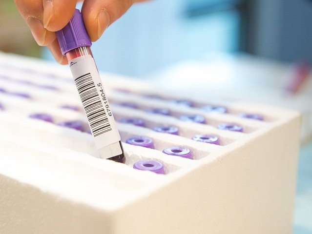 Hervorragender Schutz für empfindliche Inhalte Umverpackung für empfindliche Güter